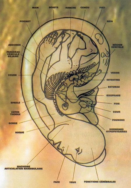 Zones de l'oreille correspondant aux parties du corps
